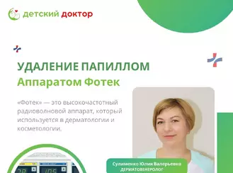 Удаления папиллом аппаратом «Фотек»