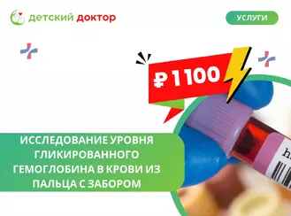 Исследование уровня гликированного гемоглобина