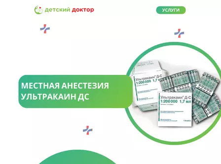 Местная анестезия  Ультракаин ДС