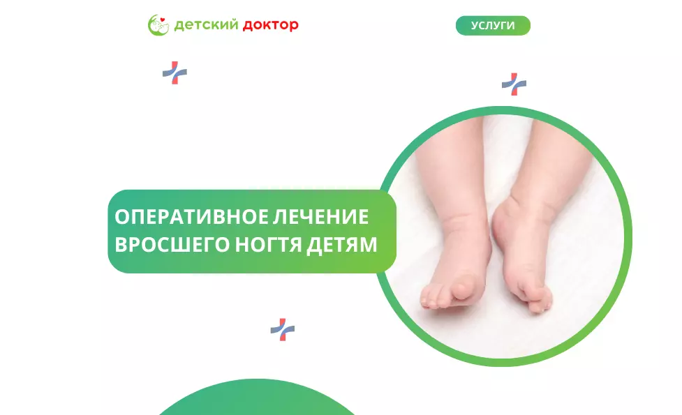Оперативное лечение вросшего ногтя